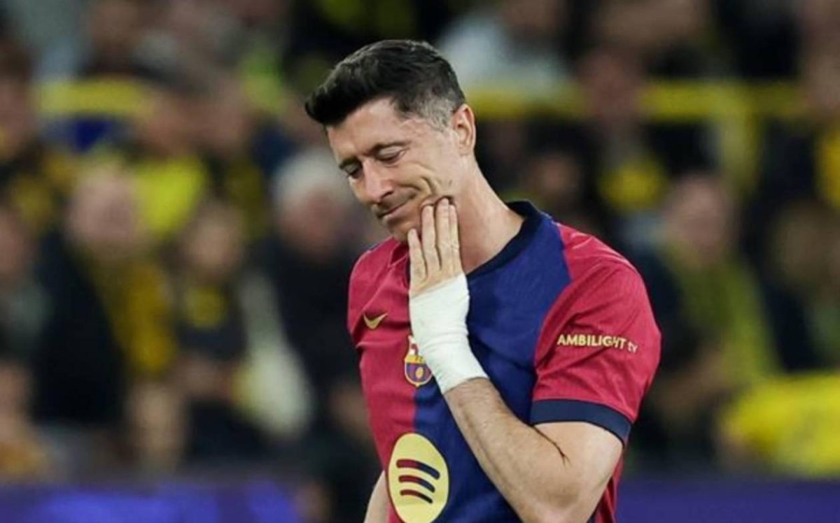 Parte médico oficial y tiempo de baja de Lewandowski