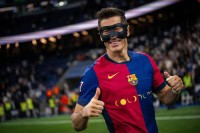 Lewandowski podría jugar con máscara en San Mamés Lewandowski podría jugar con máscara en San Mamés